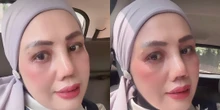 Elly Sugigi Ungkap Alasan Jalani Operasi Plastik pada Bagian Ini
