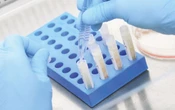 Stem Cell Bisa jadi Alternatif Penyembuhan Cedera Organ Tubuh