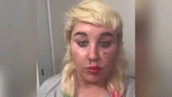 Amanda Bynes reveals she is taking Ozempic