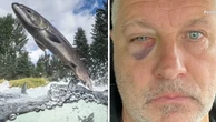 Man suffers black eye after he is smacked in face by 15lb salmon fish