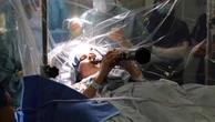 Woman plays clarinet during four-hour brain surgery for Parkinson’s
