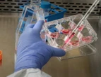 Estudo da USP identifica proteínas envolvidas na eficácia de imunoterapia usada contra câncer no sangue