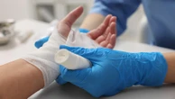 SUS terá transplante de membrana amniótica para queimados: como funciona?