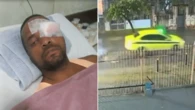 Tampa solta de bueiro faz carro 'voar' e taxista perde a visão de um olho