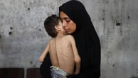 Fome mata um palestino a cada 6 horas em Gaza; alimentos estão na fronteira Jamil Chade