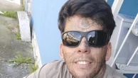 'Mais tatuado do Brasil' passa pela 4ª sessão de remoção; veja resultados