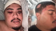 Estudante espancado na saída de boate no RJ: 'Pensava: eu não posso morrer'