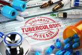 Faster tests, shorter treatments: How new tech could help slow down drug-resistant TB