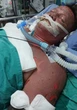 Ervare skipper (39) van SA brand erg in ontploffing langs Thaise kus