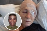 Só lyk man wat glo Kampsbaai-vrou se oog op Tafelberg wou uitkrap