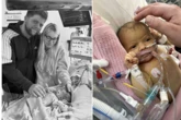 My baby daughter died from a virus that's passed on by a kiss