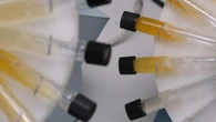 British athlete reportedly under investigation in doping case against Eric Lira