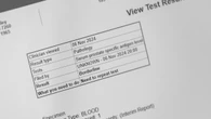 Prostate cancer blood tests ‘can lead to men being over-tested’, experts say