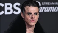 Yungblud to break from touring until the end of the year on advice of doctor