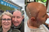 I thought I smelled candy floss. Then doctors found a brain tumour