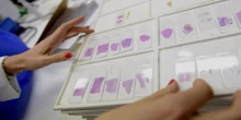 Un estudio concluye que el cribado en cáncer de ovario no salva vidas
