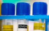 Waterloo Region COVID-19 numbers remain high as most of Ontario continues to get better