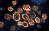 76 COVID-19 cases now connected to outbreak in Waterloo Region congregate setting