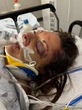 Montreal cyclist says it’s a ‘miracle’ she’s alive after hitting a pothole, going into coma