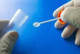 Colorectal cancer rising in young adults. Should the screening age be lowered?