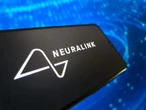 2 Toronto hospital patients get Elon Musk’s Neuralink implants in Canadian 1st