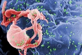 Toronto man’s HIV in remission after bone marrow transplant to treat cancer