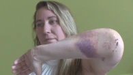 Second victim of alleged Kelowna hammer attack mourns the loss of friend