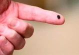 What to know about Lyme disease amid ‘steady increase’ in Canada, U.S.