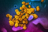 AstraZeneca’s antibody cocktail failed to prevent COVID-19 symptoms in large trial
