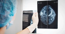 Study reveals how fat cells can fuel cancer tumors