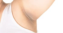 What is deodorant concealer and is the viral product safe? Derms weigh in