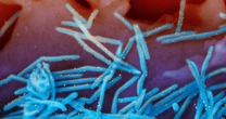 CDC strengthens RSV vaccine recommendation only for the oldest adults 