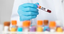 New cholesterol drug lowers LDL when statins aren’t enough, study finds