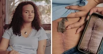 Her spine surgery was denied. Doctors say it’s all too common.