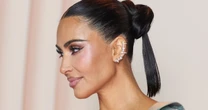 What to know about brain aneurysms after Kim Kardashian's diagnosis