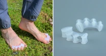 How toe separators help with foot pain, according to foot surgeons