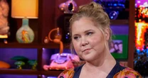 Amy Schumer says criticism over her 'puffy' face led to Cushing syndrome diagnosis