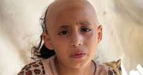 'Psychologically broken,' 8-year-old Sama loses her hair