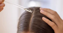 Hair oil and scalp oil are not the same thing — here’s what experts want you to know