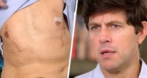 California shark attack survivor recalls 'tussling' with animal and screaming for help