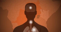 Tracking the Ebola outbreak: Where the deadly virus is spreading and how the U.S. is responding 