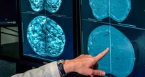 When should you get a mammogram? Conflicting advice makes it hard to know