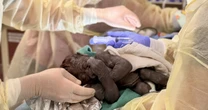 Baby gorilla delivered via rare C-section at Washington State zoo