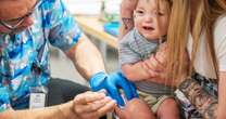 Babies under 1 typically don’t get the measles vaccine. Can they get a dose early? 