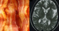 Eating more processed red meat is linked to an increased risk of dementia, study suggests