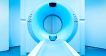 Some CT scans may have too much radiation, researchers say