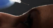 What is Innotox? People on social media are self-injecting 'Korean botox' at home