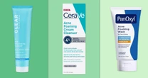 The best benzoyl peroxide products, according to derms