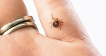 First death reported from meat allergy caused by tick bite