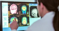 Mysterious brain diseases in Canada weren’t a mystery after all